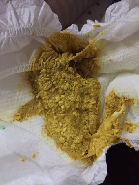 放的屁特别臭,但是却拉不出大便,是怎么回事呢怎么办