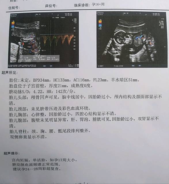 17周了_17周做的二维彩超,其中有几个部位说因胎儿过