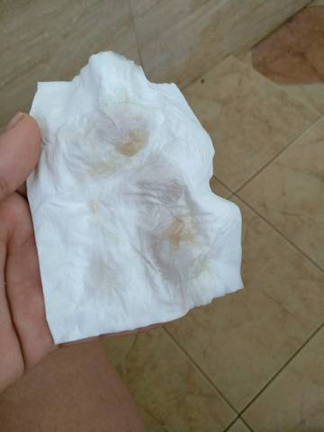 怀孕38周,这个是什麼?