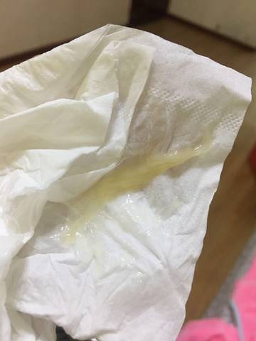 3月20的预产期、平时尿液偏黄、今天早上起来