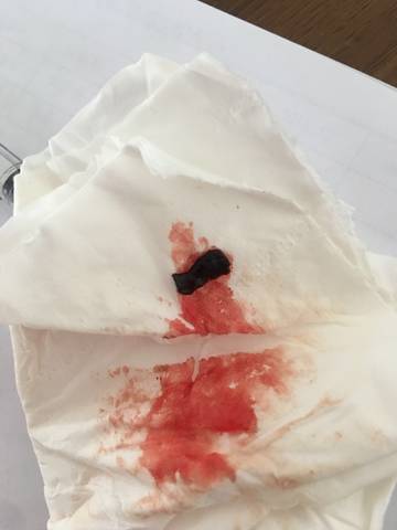 怀孕28周了,昨天和老公同房,早上有点见红,今天