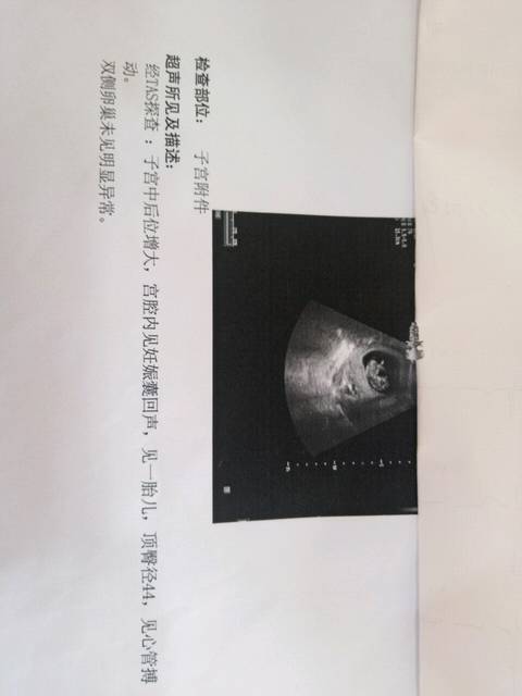 宝妈们,帮忙看下高清女生。头像取名字头像女孩背影qq男孩早点图片