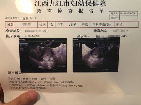 圈子 九江市妇幼保健院  第一次怀孕,以前月经不太规则,黄体酮不足,有