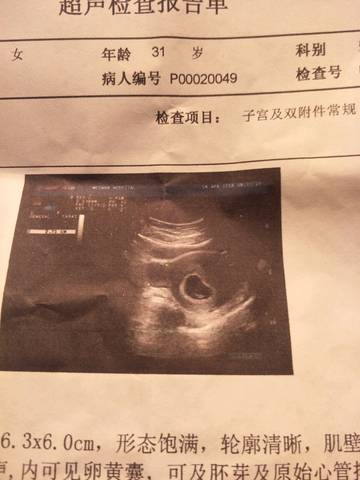 我怀孕八周的孕囊是3.1×2.7cm,是男孩还是女孩