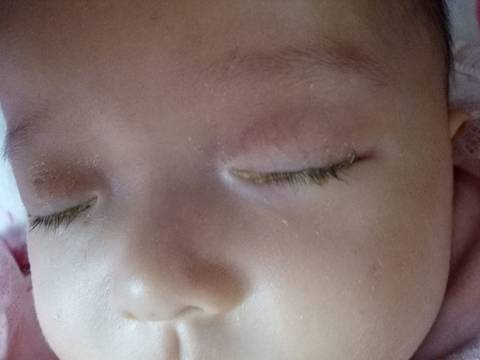 宝宝眼睛里有很多眼屎,清理完没一个小时眼睛