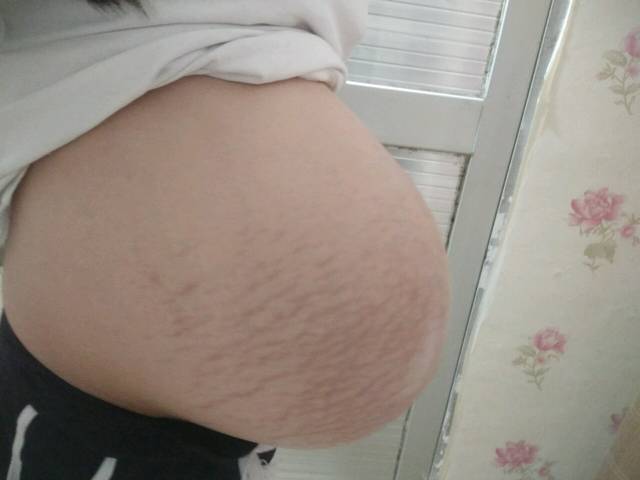 我的肚子像悬浮肚?