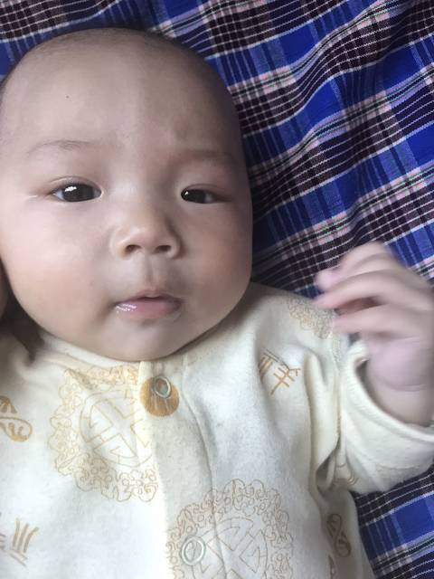 宝妈们帮忙看看,宝宝额头有突出的一条线,怎么