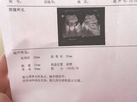 四个月的b超能看出男女吗?好奇心比较重 有没有大神能