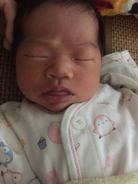 我宝宝是唐氏儿吗,总是露舌头!