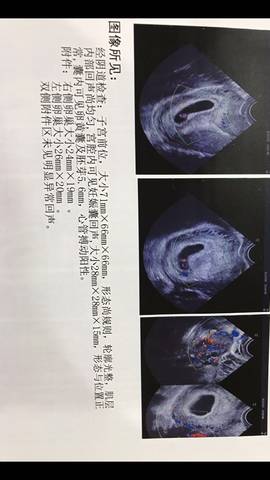 听别人说早期的孕囊数据可以看男女,各位亲们帮我看下