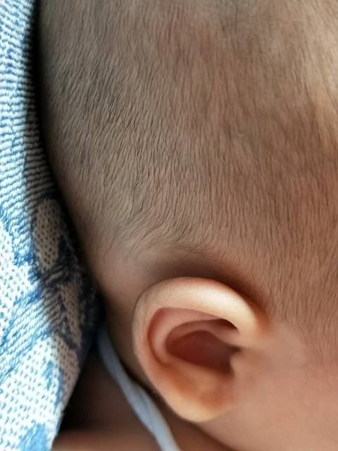 看看宝宝耳后的疙瘩是什么