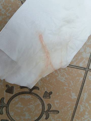 昨晚排卵期同房今天早晨上厕所 擦下纸上有一点点血丝
