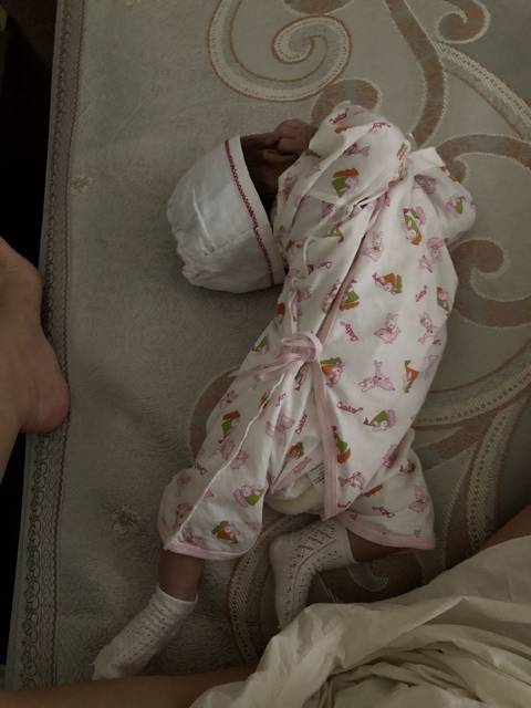 两个月婴儿睡觉头往后仰