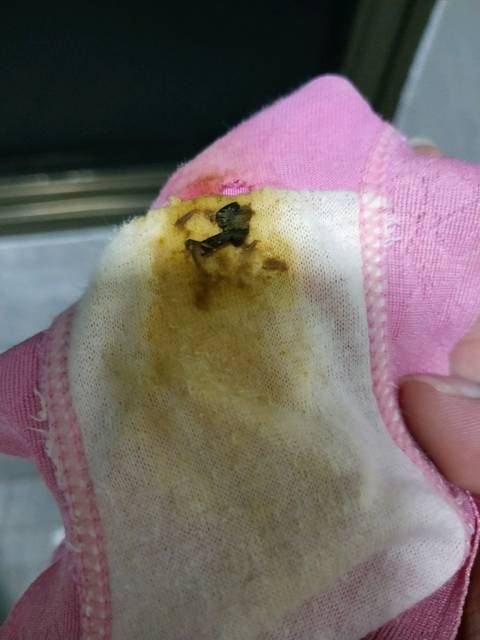 这是临产前分泌物