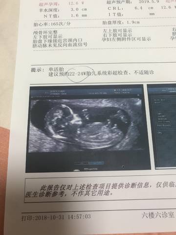 各位会nt看男女的宝妈们 帮忙看一下是男宝宝还是女宝宝 内心有些小