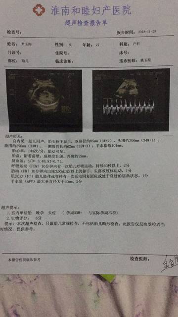 宝宝之前检查一直是偏小怎么回事