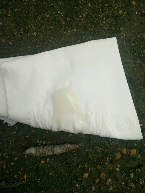 大家帮忙看看白带正常吗?怀孕初期