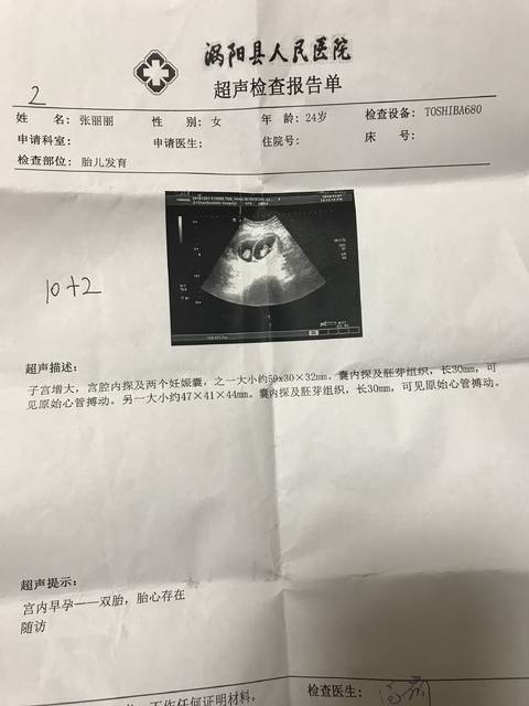异卵双胞胎看男女,