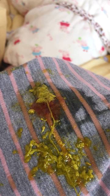 满月宝宝拉稀拉绿色便便带有奶瓣,今天便便里