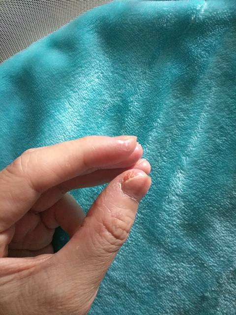 有手藓怀孕了会对宝宝有影响吗?