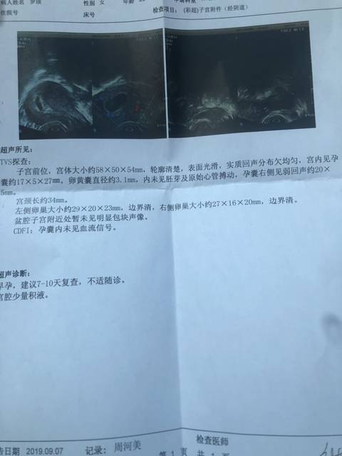 有没有绒毛膜下血肿,黄体功能不全的!