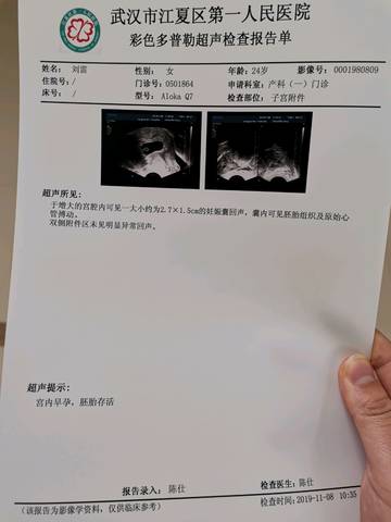 孕囊看男女,我这是圆型还是茄子型啊?