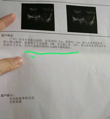 平躺肚子会鼓鼓,有发困的感觉?我想问,怀孕快