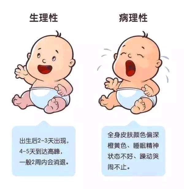 小孩黄疸会有什么症状?_家长们都知道,宝宝出生后不久