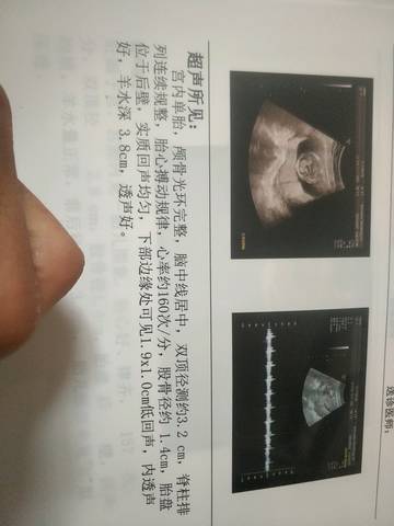 帮我看看男女呗亲们,15周了医生说是男孩,期待女孩,不管男宝女宝都一