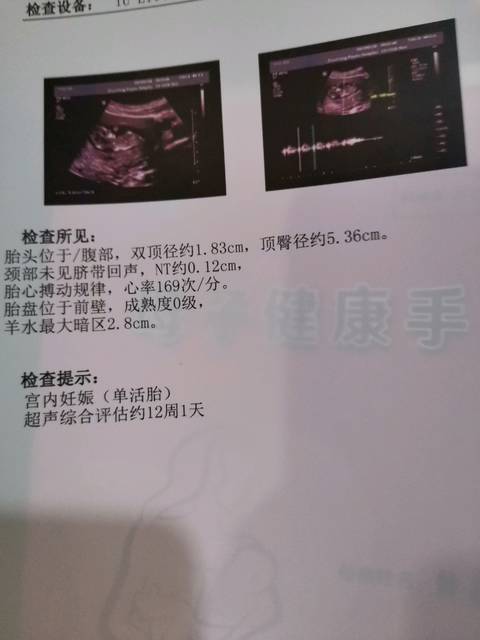 nt单子能看男女吗?