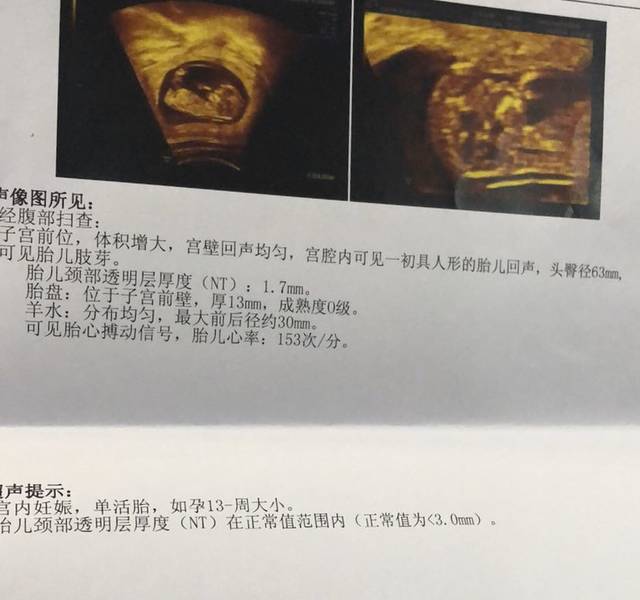 nt看男女,麻烦大家帮我看看是男生还是女生哈,谢谢