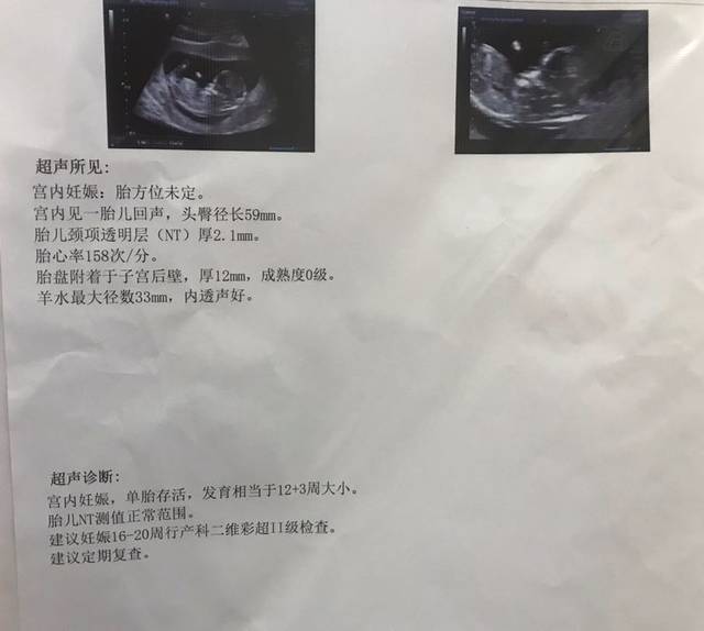 nt过了,十二周3天的彩超