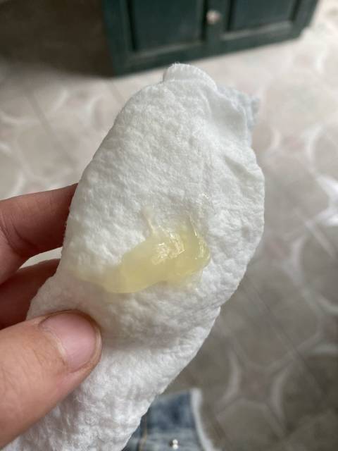 看看这是什么情况