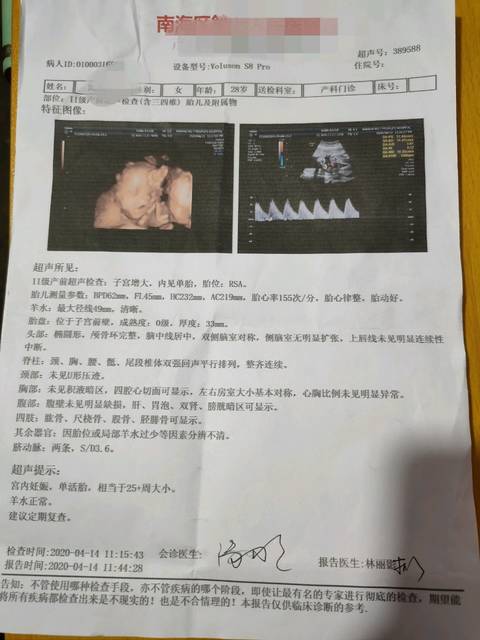 1预产期的宝妈_唐氏筛查,四维,糖耐都亮绿灯
