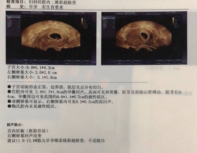 孕5周,孕吐时排出淡褐色液体,马上去医院检查孕囊旁有