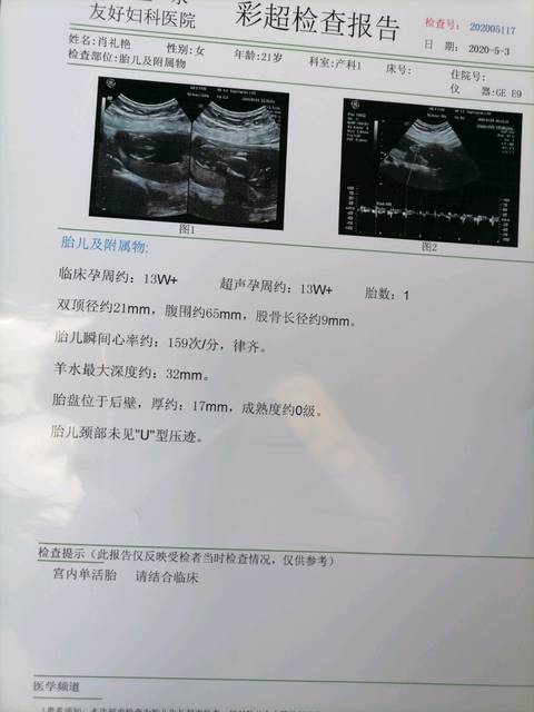 怀孕13周 有知道是男孩女孩的吗