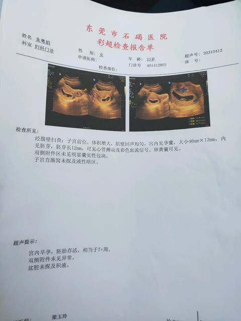 由圆变长的孕囊
