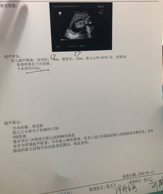 新鲜b超单_下午去照了个b超,医生说宝宝在动,一开始15