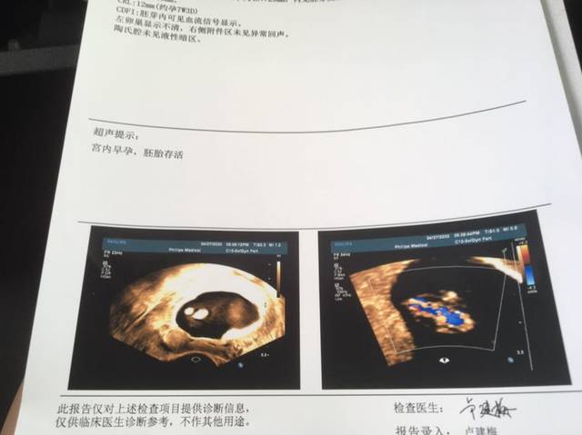 宝妈们,帮我看看孕囊这个形状的,是男孩还是女孩