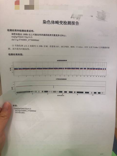 13号染色体微缺失0.2mb,该何去何从