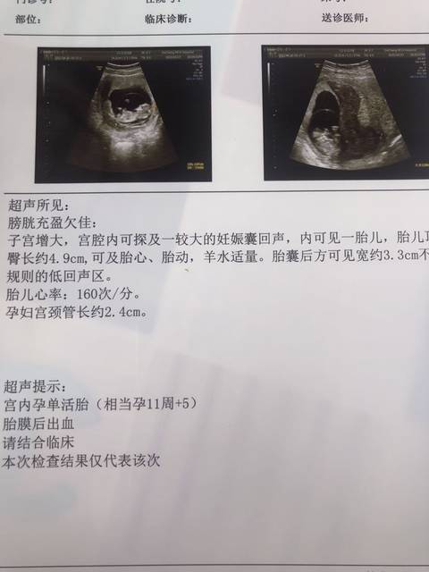 12周左右ntb超单子看男女的发来看看 娱乐一下