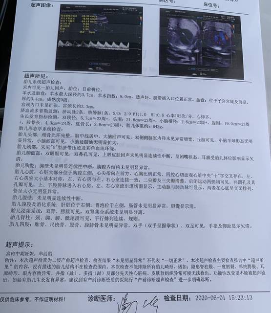 5d彩超一次过