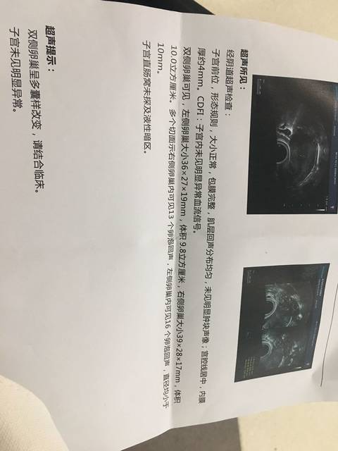 双侧多囊卵巢呈多囊样改变,有治好的吗?怎么治疗的?