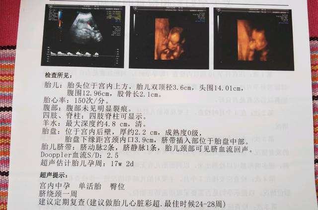 16周5天的四维单