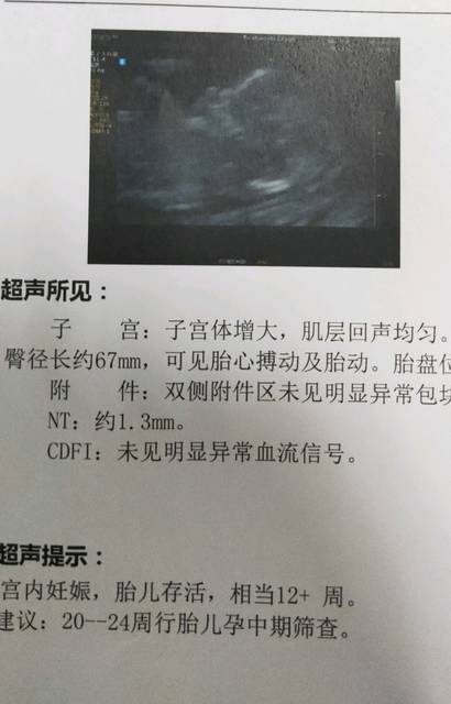nt 看女宝男宝