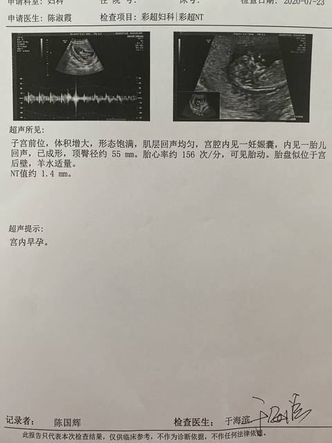 孕12周 nt顺利通过_nt顺利通过来还愿 彩超能看出男女