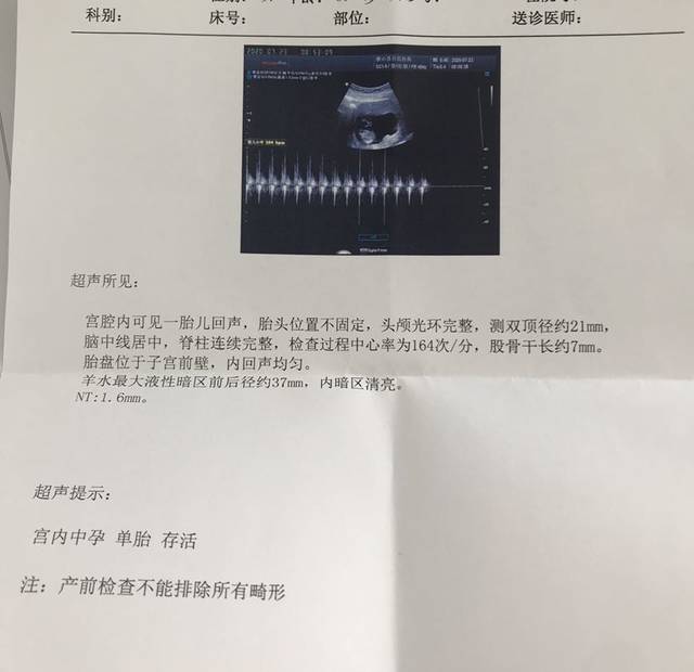nt单子