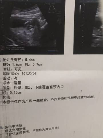 nt能看男女?