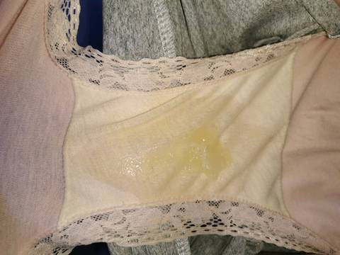 今天早上流的是这个黄色的宫颈粘液,内裤看起来有点湿了