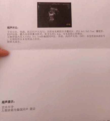 journal_insert_pic_1516346920